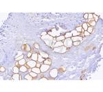 Perilipin 1 Antibody in Immunohistochemistry (Paraffin) (IHC (P))