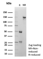 Hepatocyte nuclear factor 1 beta (HNF1b)/Transcription Factor 2 (TCF2) Antibody in SDS-PAGE (SDS-PAGE)