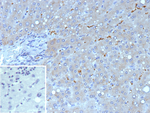 Hepatocyte nuclear factor 1 beta (HNF1b)/Transcription Factor 2 (TCF2) Monoclonal Antibody (HNF1B/9519)