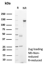 Hepatocyte nuclear factor 1 beta (HNF1b)/Transcription Factor 2 (TCF2) Antibody in SDS-PAGE (SDS-PAGE)