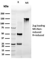 MLX Antibody in SDS-PAGE (SDS-PAGE)