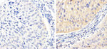 Phospho-FAK (Tyr576) Antibody in Immunohistochemistry (Paraffin) (IHC (P))