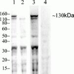 Phospho-JAK1 (Tyr1034, Tyr1035) Antibody in Western Blot (WB)