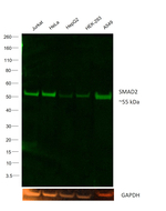 SMAD2 Antibody in Western Blot (WB)