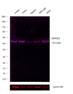SMAD2 Antibody in Western Blot (WB)