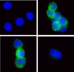 Phospho-Zap-70 (Tyr315, Tyr319) Antibody