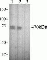 Phospho-Zap-70 (Tyr315, Tyr319) Antibody in Western Blot (WB)