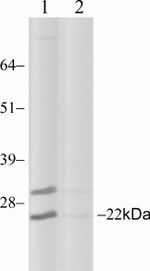 RAB11A Antibody in Western Blot (WB)