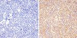 Phospho-STAT6 (Tyr641) Antibody in Immunohistochemistry (Paraffin) (IHC (P))