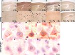 beta Amyloid Antibody in Immunohistochemistry - Free Floating (IHC (Free))