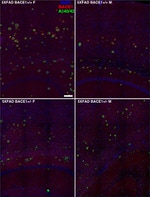 beta Amyloid Antibody in Immunohistochemistry (IHC)