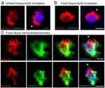 beta Amyloid Antibody in Immunohistochemistry (PFA fixed) (IHC (PFA))
