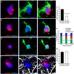 beta Amyloid Antibody in Immunohistochemistry (PFA fixed) (IHC (PFA))