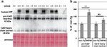 beta Amyloid Antibody in Western Blot (WB)