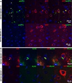beta Amyloid Antibody in Immunohistochemistry (IHC)