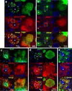 beta Amyloid Antibody in Immunohistochemistry (IHC)