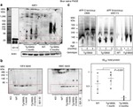beta Amyloid Antibody in Western Blot (WB)