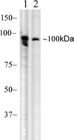 RIG-I Antibody in Western Blot (WB)