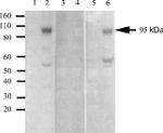 Phospho-IR/IGF1R (Tyr1162, Tyr1163) Recombinant Rabbit Monoclonal Antibody (97H9L7)