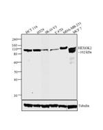 HK2 Antibody in Western Blot (WB)