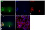 HK2 Antibody in Immunocytochemistry (ICC/IF)