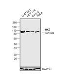 HK2 Antibody in Western Blot (WB)