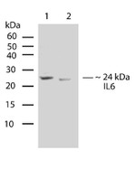 IL-6 Recombinant Rabbit Monoclonal Antibody (C7H24L3)