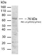 Phospho-PKC lambda/iota (Thr555, Thr563) Antibody in Western Blot (WB)