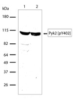 Phospho-PYK2 (Tyr402) Recombinant Rabbit Monoclonal Antibody (17H4L19)
