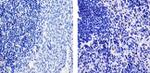 TARC Recombinant Rabbit Monoclonal Antibody (B22H33L5)