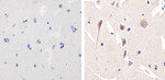 NMDAR1 Recombinant Rabbit Monoclonal Antibody (1H13L3)