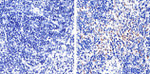 FOXP3 Recombinant Rabbit Monoclonal Antibody (5H10L18)