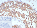 CD202b/TIE2/TEK (Tyrosine Kinase with Ig and EGF Homology Domains 2) Antibody in Immunohistochemistry (Paraffin) (IHC (P))