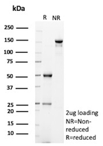 CD202b/TIE2/TEK (Tyrosine Kinase with Ig and EGF Homology Domains 2) Antibody in SDS-PAGE (SDS-PAGE)