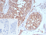 CD202b/TIE2/TEK (Tyrosine Kinase with Ig and EGF Homology Domains 2) Antibody in Immunohistochemistry (Paraffin) (IHC (P))