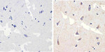 Phospho-p38 MAPK (Thr180, Tyr182) Antibody in Immunohistochemistry (Paraffin) (IHC (P))