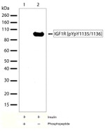 Phospho-IGF1R beta (Tyr1135, Tyr1136) Recombinant Rabbit Monoclonal Antibody (15H10L8)