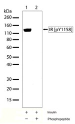 Phospho-INSR (Tyr1158) Recombinant Rabbit Monoclonal Antibody (8H20L22)