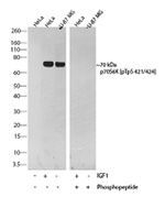 Phospho-p70 S6 Kinase (Thr421, Ser424) Recombinant Rabbit Monoclonal Antibody (B12H16L8)