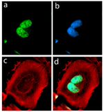alpha Synuclein Antibody in Immunocytochemistry (ICC/IF)