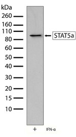 STAT5 alpha Recombinant Rabbit Monoclonal Antibody (6H2L9)
