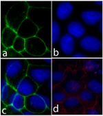 E-cadherin Recombinant Rabbit Monoclonal Antibody (5H6L18)