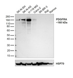PDGFRA Antibody in Western Blot (WB)