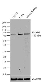 SMAD1 Recombinant Rabbit Monoclonal Antibody (12H1L14)