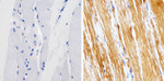 Metadherin Antibody in Immunohistochemistry (Paraffin) (IHC (P))