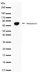 Metadherin Antibody in Western Blot (WB)