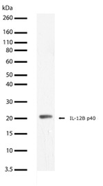 IL-12 p40 Recombinant Rabbit Monoclonal Antibody (21 H19L14)