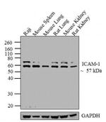 ICAM-1 Recombinant Rabbit Monoclonal Antibody (9H21L19)