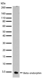 Beta Endorphin Recombinant Rabbit Monoclonal Antibody (20H4L2)