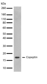 Copeptin Recombinant Rabbit Monoclonal Antibody (20H24L10)